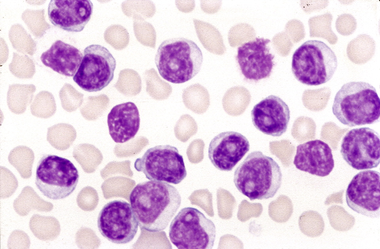 Перепрограммированные Т-лимфоциты